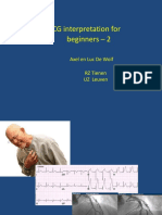 ECG Interpretation For Beginners Deel 1