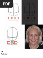 DSD Simple Template3