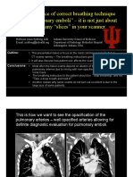 CT For PE Breathing Technique PRESENTATION