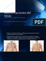 Malformaciones Del Torax