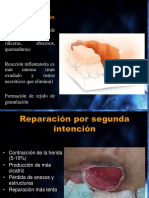 Cicatrización Por Segunda