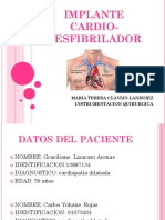 Implante Cardio-Desfibrilador