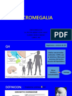 Acromegalia