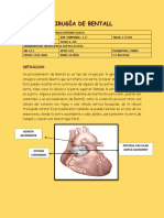 Cirugia de Bentall Informe