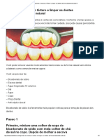 Aprenda A Remover o Tártaro e Limpar Os Dentes de Forma Totalmente Natural