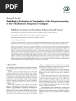 Irrigation in Endodontics