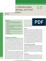 Pathophysiology of Cataract 2