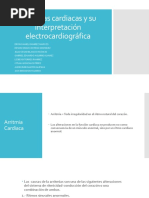 Arritmias Cardiacas y Su Interpretación