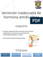 Secrecion Inadecuada de La Hormona Antidiuretica