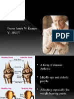 Franz Louis M. Evasco V - Bsot: Osteoarthritis