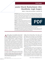 Masseter Muscle Reattachment After Mandibular Angle Surgery