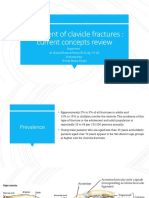 Treatment of Clavicle Fractures