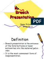 Breech Presentation-Pritiss Nair Group 2