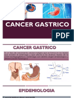 Cancer Gastrico