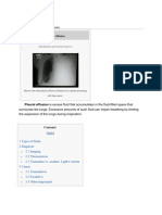 Pleural Effusion