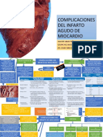 Complicaciones Del Infarto Agudo de Miocardio