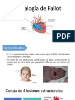 Tetralogía de Fallot