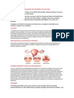 Ligadura de Trompas de Falopio