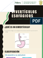 Divertículos Esofágicos