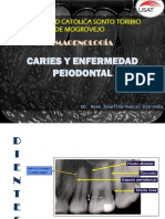 Caries y Enfermedad Periodontal