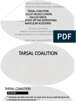 Coalisao Tarsal, Halux Valgo e Varo, Serpentina e Navicular Acessório