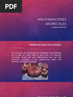 Malformaciones Anorectales