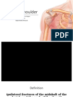 Floating Shoulder: Sri Pramesthi Wisnu Bowo Negoro 20174011069 Bagian Bedah Orthopedi