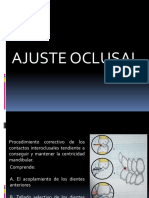 Ajuste Oclusal