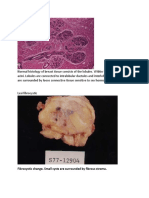 Normal Histology of Breast Tissue Consists of The Lobules