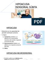 Hipoacusia Neurosensorial Súbita