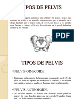 Tipos de Pelvis