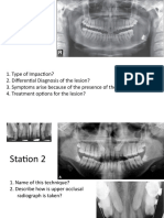 Oral Surgery - Questions