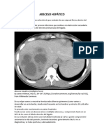 Absceso Hepático