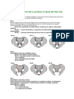 Clasificacion de Las Fracturas de Pelvis