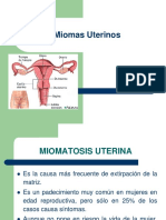 Miomas Uterinos Ok-1