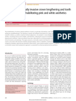 Al-Harbi - 2018 - A Guide To Minimally Invasive Crown Lengthening and Tooth Preparation For Rehabilitating Pink and White Ae