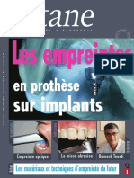 Les Empreintes en Prothèse