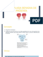 Hiperplasia Benigna de Próstata