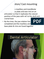 Articulation Cast Mounting and Teeth Arrangement