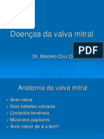 Doenças Da Valva Mitral