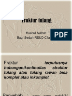 Fraktur Tulang: Husnul Author Bag. Bedah RSUD Cilacap