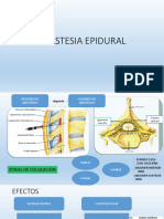 Anestesia Epidural