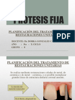 Protesis Fija