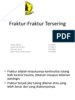  Fraktur-Fraktur Tersering