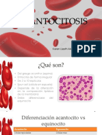 ACANTOCITOSIS