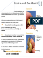 Caracol Adulto V Juvenil Como Distingui-Los PDF