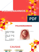 POLIHIDRAMNIOS