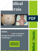 Hernia Umbilikalis