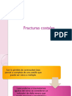 Fracturas Costales