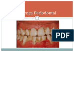 AULA Periodontia 